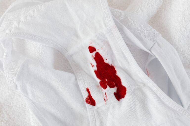 Cum scoți petele de sos, ulei și vin de pe haine și fețe de masă Pată de vin roșu pe o față de masă albă, lângă un pahar răsturnat și un șervețel